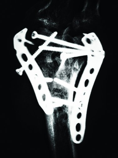 IMG_20190317_195717156-01 (1)