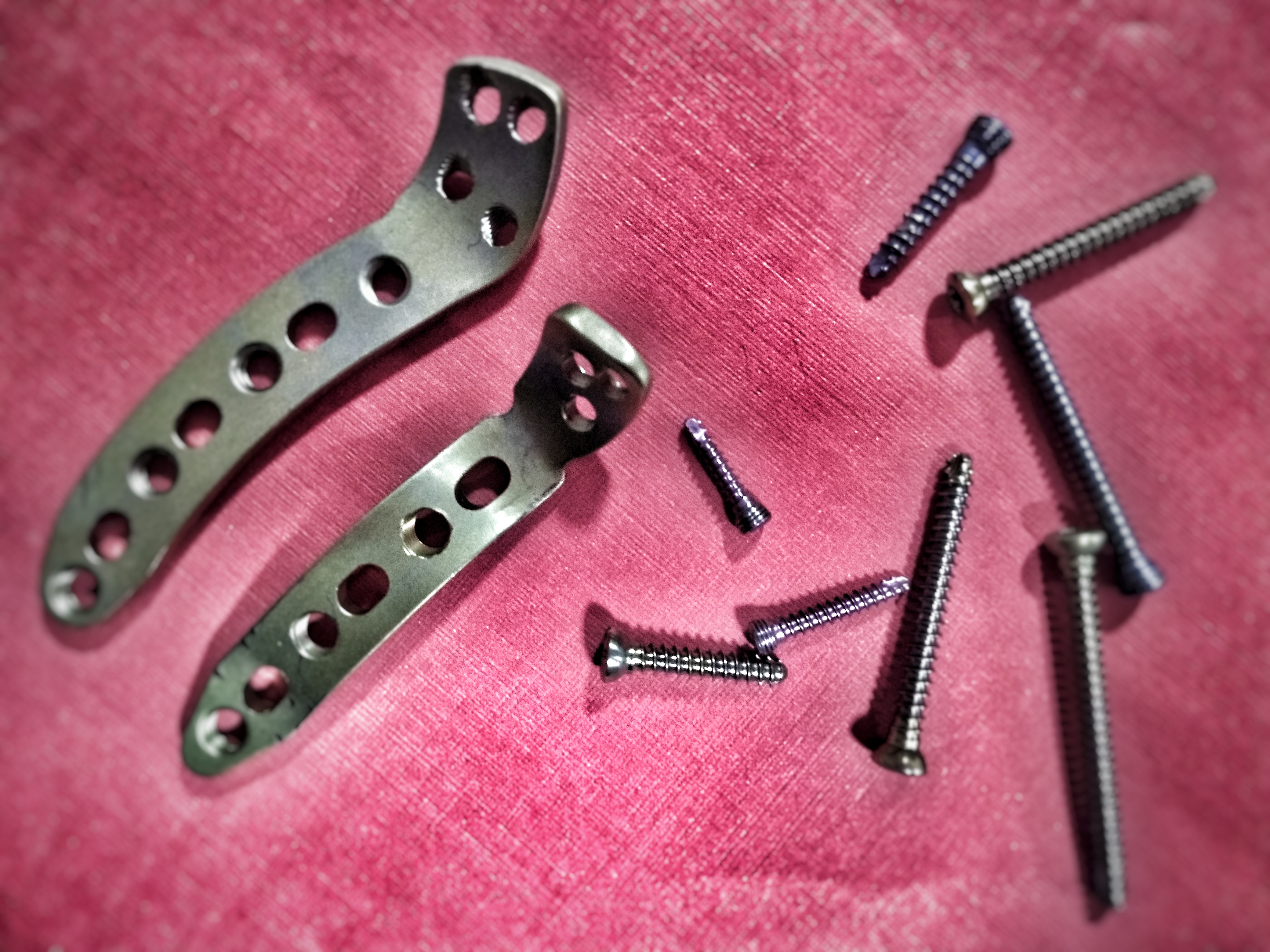 placas e parafusos.jpeg